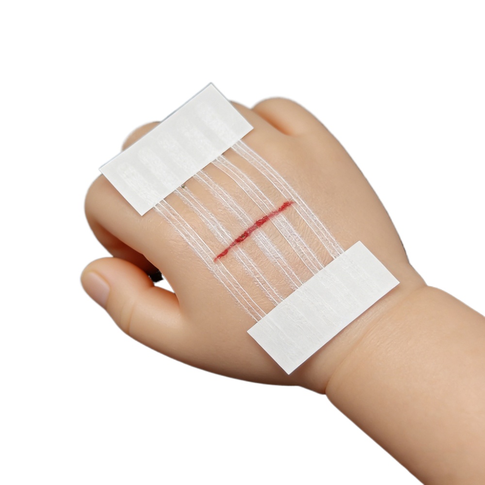 Medical Label - 5 ストリップ創傷皮膚閉鎖ストリップ産後創傷修復美容外科ストリップ粘着医療用縫合糸フリー手術用テープ
