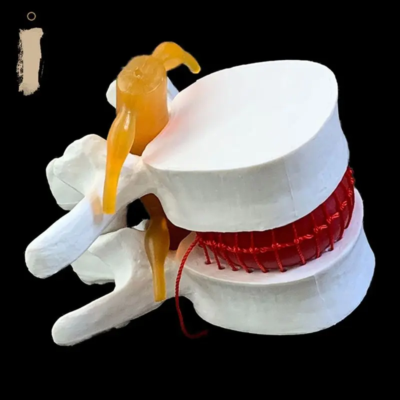 解剖学的人間の腰椎変性腰椎椎間板ヘルニアのデモンストレーショ - Examination Bed Medical のレビューと価格
